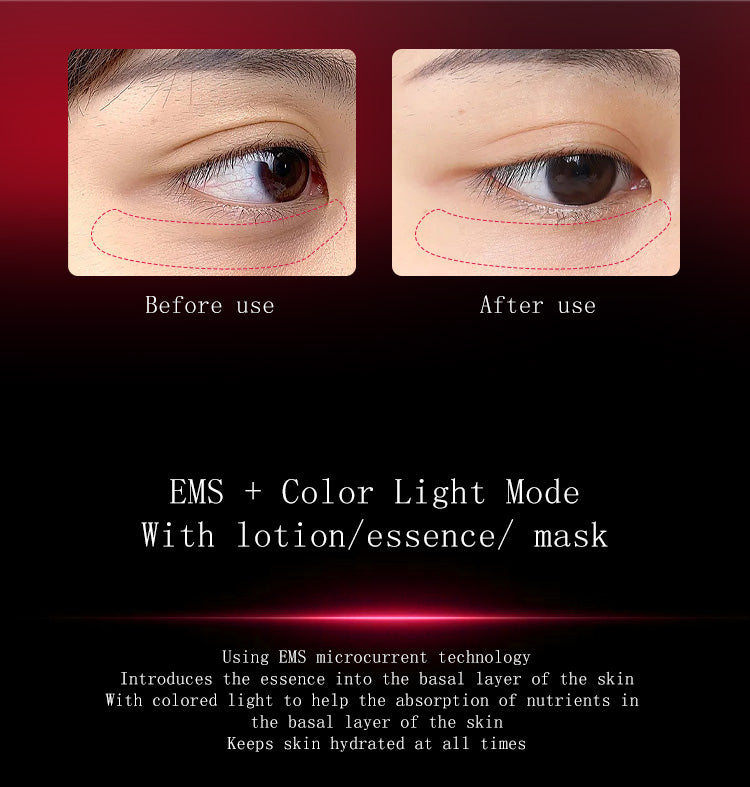 EMS Photon Vibro-Infusion Lifting Beauty Device