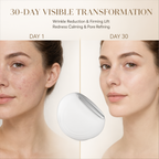 EMS Photon Vibro-Infusion Lifting Beauty Device