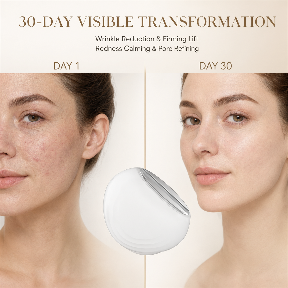 EMS Photon Vibro-Infusion Lifting Beauty Device