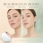 EMS Photon Vibro-Infusion Lifting Beauty Device