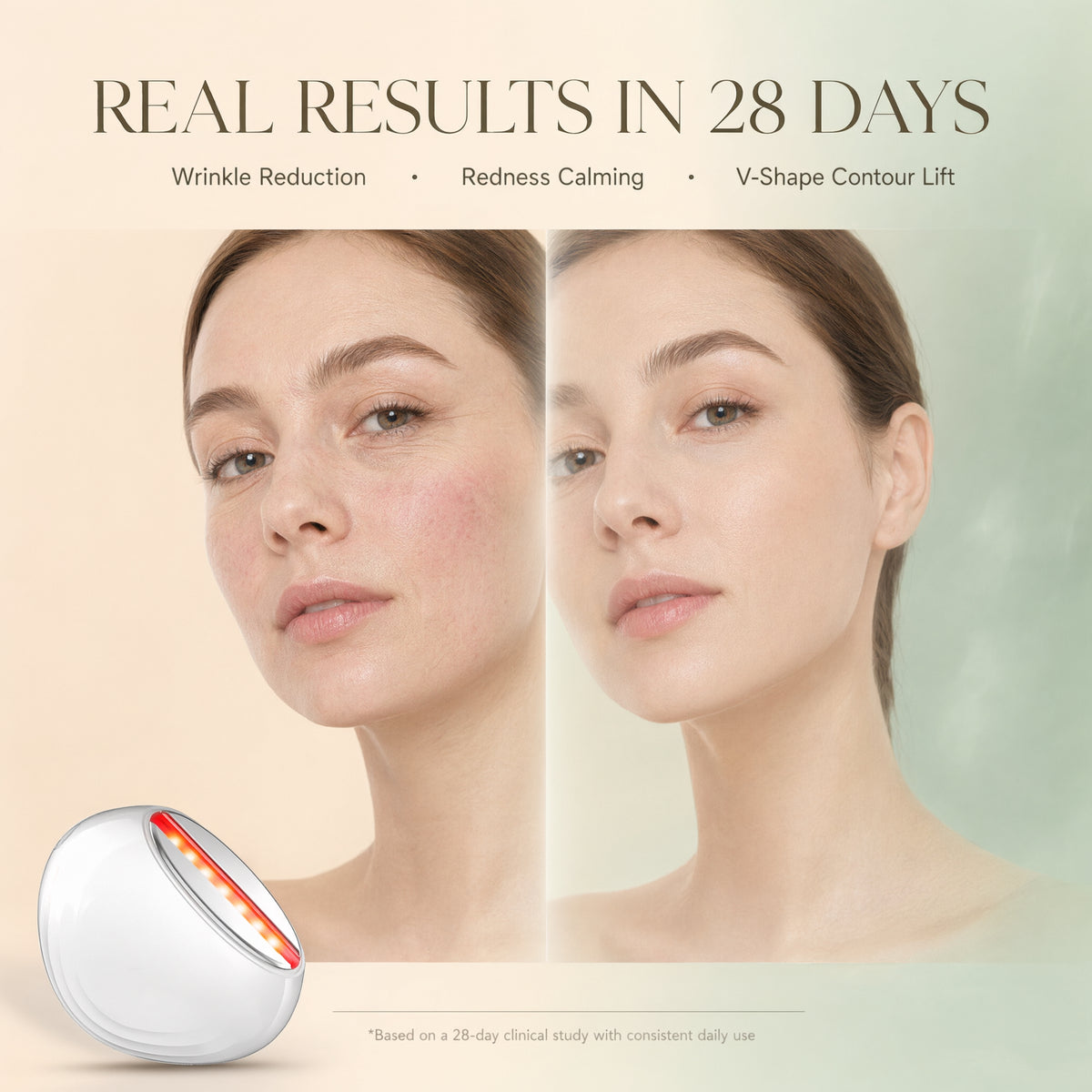 EMS Photon Vibro-Infusion Lifting Beauty Device